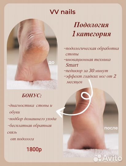 Лечебный педикюр подолог