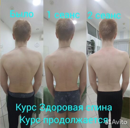 Остеопатическая коррекция, остеобаланс