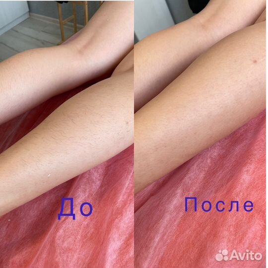 Депиляция (воск/сахар)