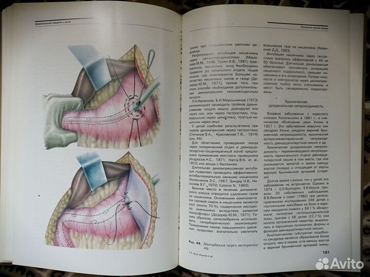 Абдоминальная хирургия у детей