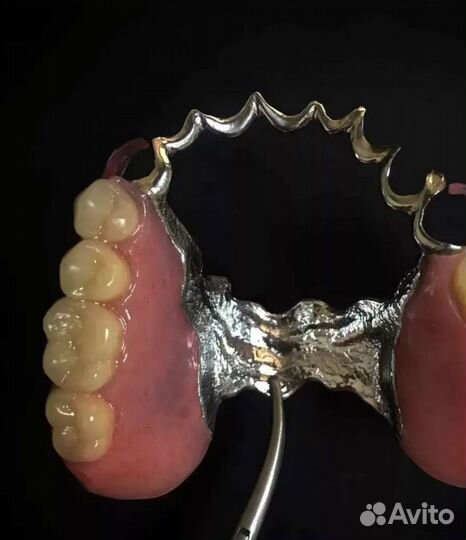 Ремонт починка и изготовление протезов