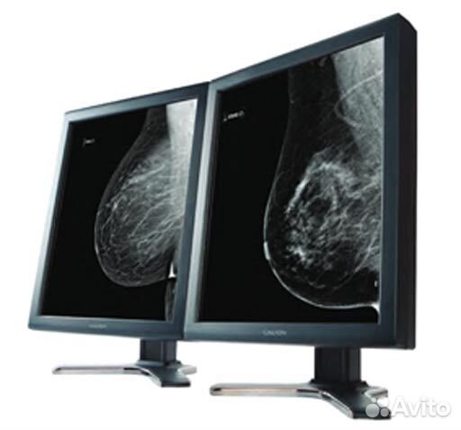 Монитор врача рентгенолога