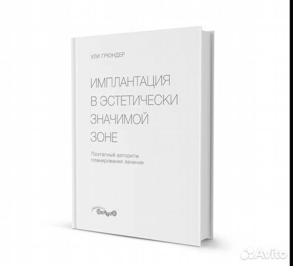 Ули грюндеримплантацияв эстетическизначимойзоне