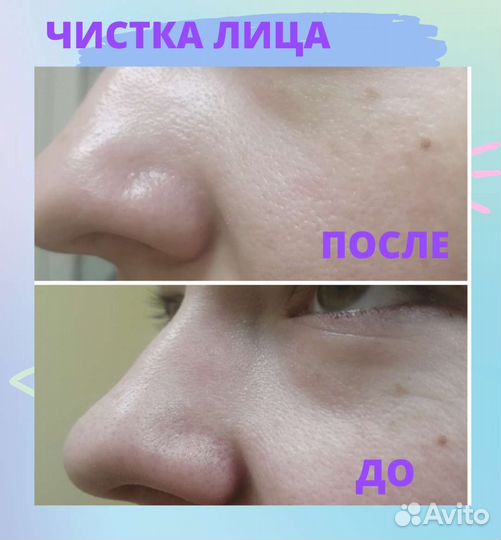 Уход за лицом,руками/ламинирование ресниц/брови