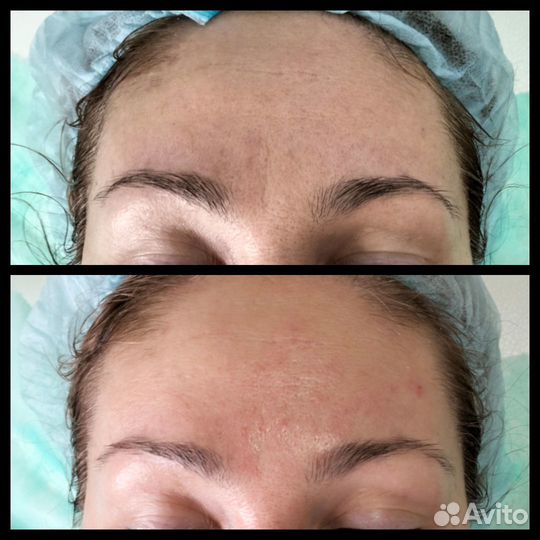 Услуги косметолога