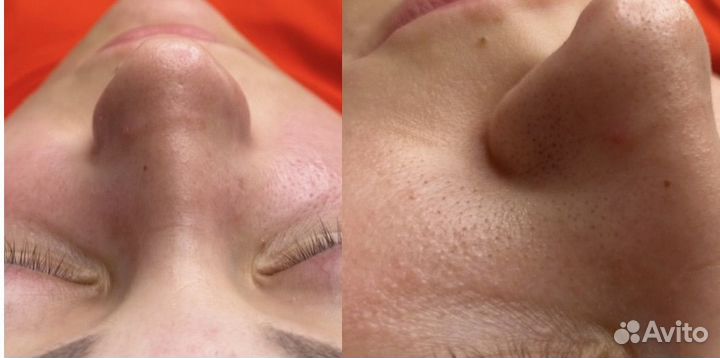 Услуги Косметолога