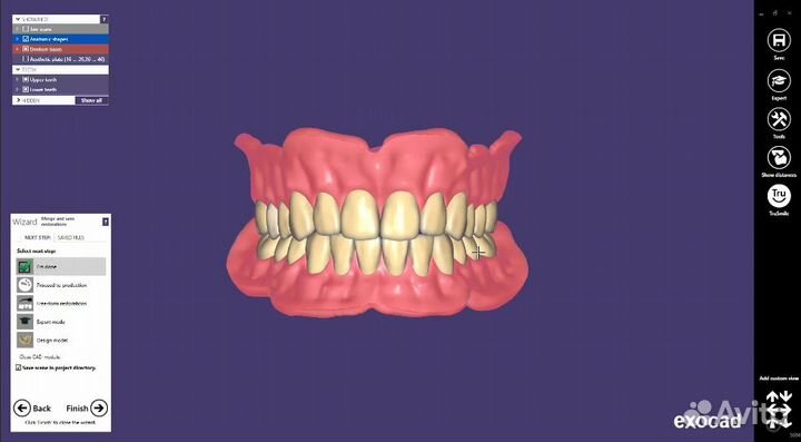 Exocad 8349 (3.1) последняя версия