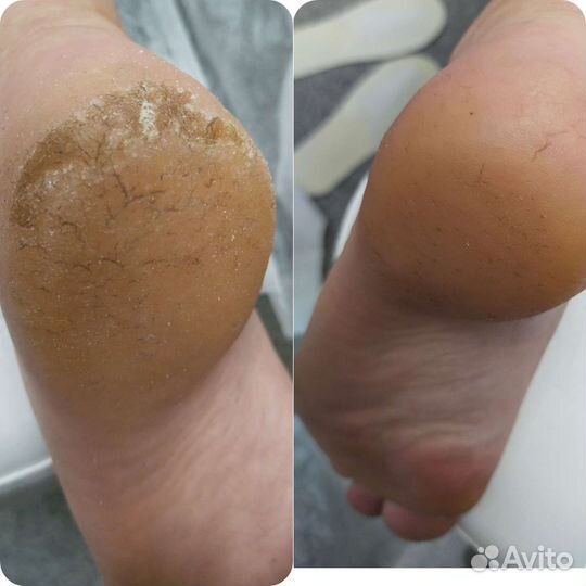 Педикюр/Подология