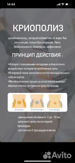 Коррекция фигуры
