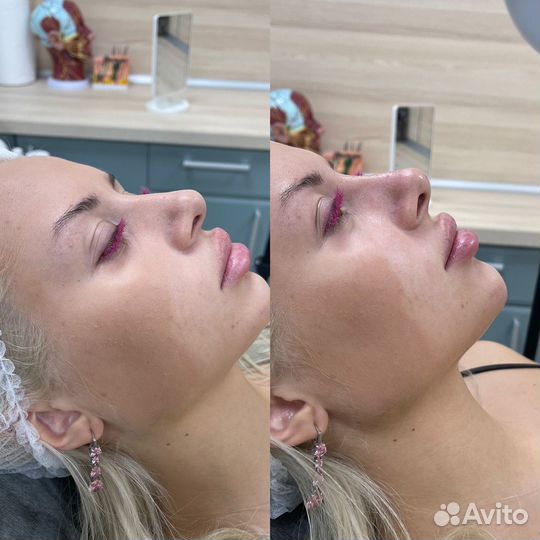 Обучение. Сестринское дело в косметологии. Диплом