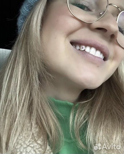 Установка скайсов