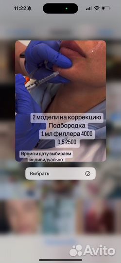 Увеличение губ, ботокс,мезотерапия
