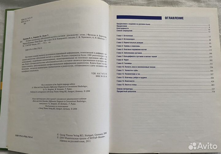 Лучевая диагностика заболеваний костей и суставов