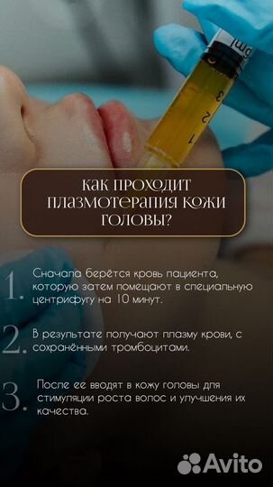 Требуется модель на обучение лечение угревой