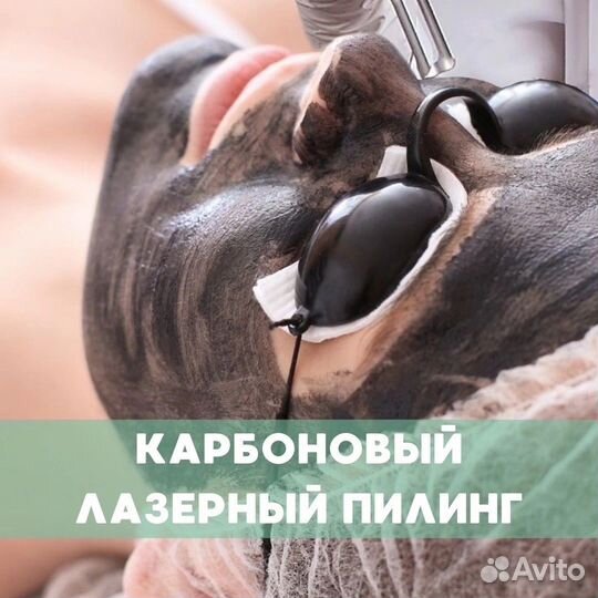 Карбоновый пилинг