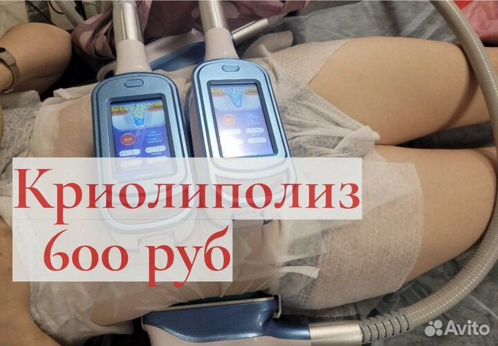 Криолиполиз, вакуумный массаж