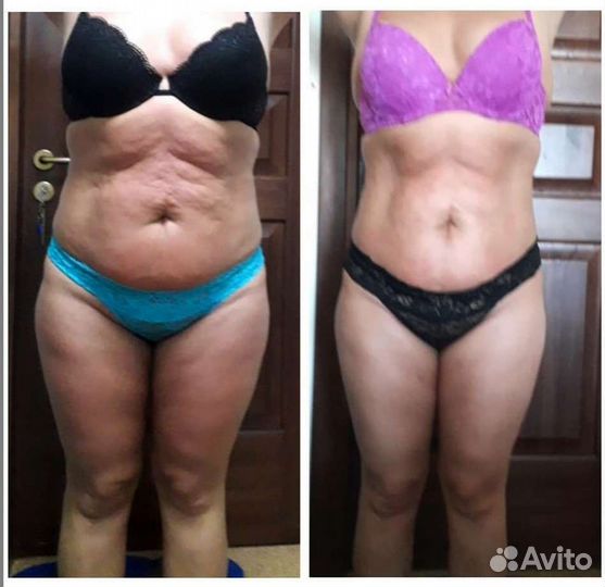 Антицеллюлитный массаж, аппаратный