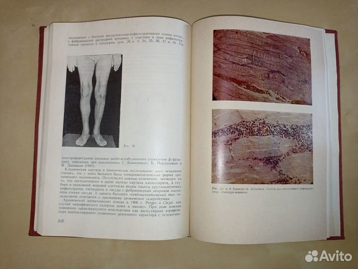 Синтетическая неврология. Божинов. 1967