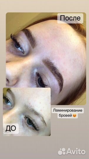 Бровист Кимры