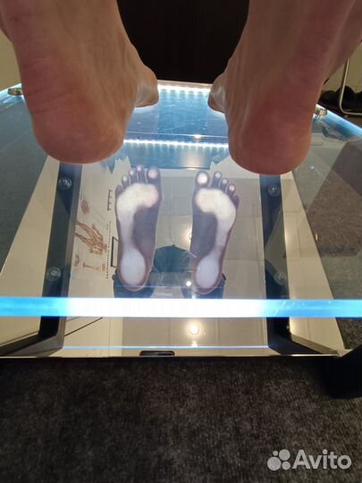 Изготовление индивидуальных ортопедических стелек