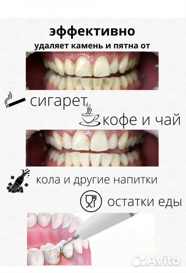 Ультразвуковой скалер