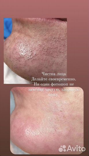 Услуги косметолога
