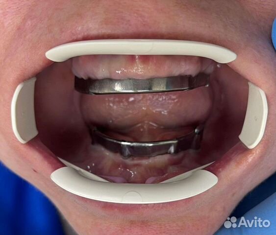 Зуботехническая лаборатория объявление продам