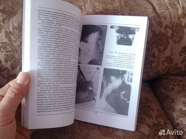 Микрохирургия челюстно-лицевой области