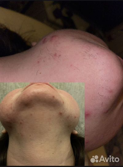 Мастер по шугарингу