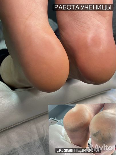 Обучение курсы smart педикюр