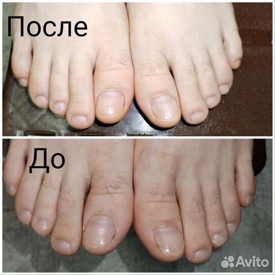 Модель на педикюр