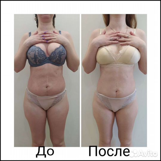 Массаж тело лицо, классика,коррекция фигуры,релакс