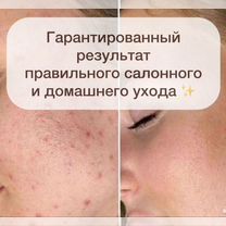 Косметолог. Чистка лица. Пилинг. Уход, Москва