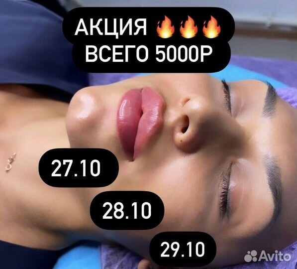 Увеличение губ