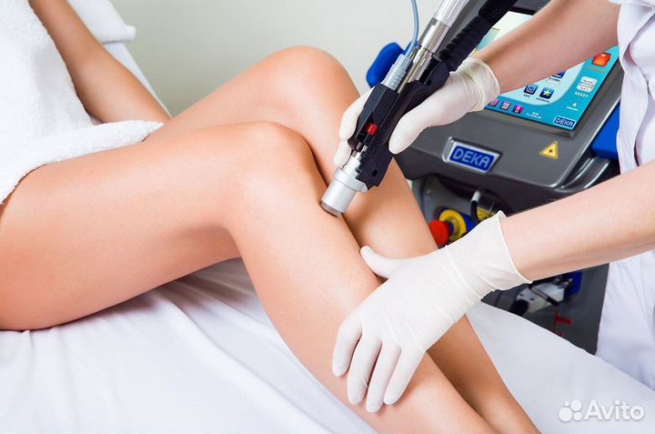 Лазерная эпиляция – стабильный доход с клиентами