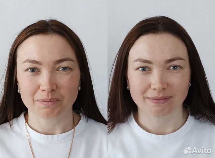 Массаж лица