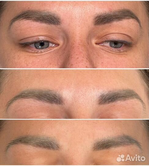 Приглашаем моделей Удаление татуажа/пм