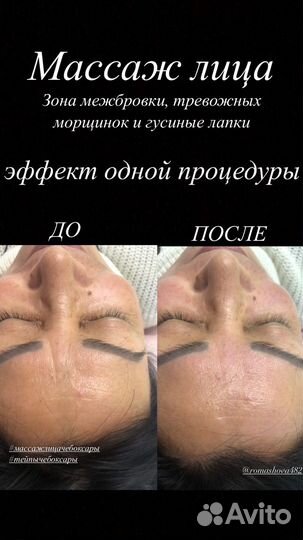 Массаж лица и тейпирование