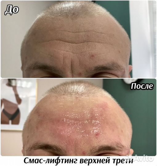 Косметология, омоложение, похудение для мужчин