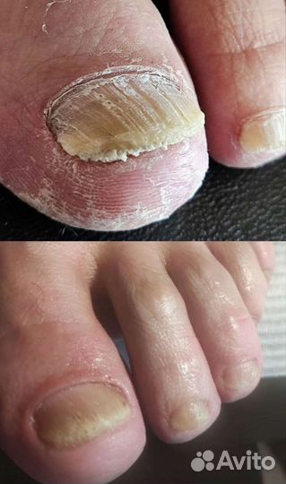 Наращивание ногтей