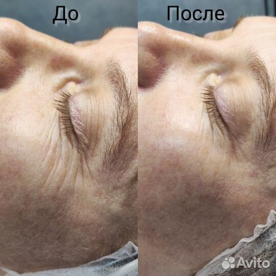 Косметолог эстетист