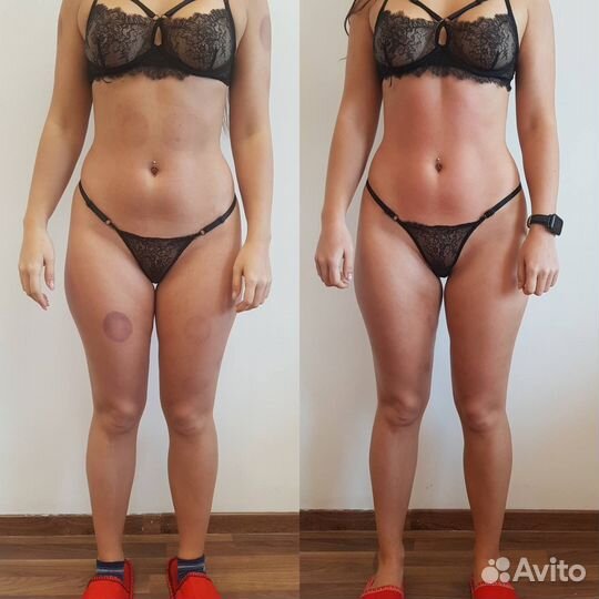 Антицеллюлитный массаж, массаж лица