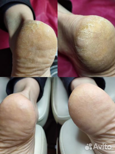 Маникюр педикюр