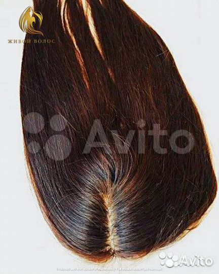 Накладка теменная