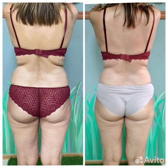 Обучение аппаратный массаж. Выдача Сертификатов