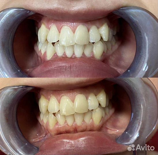 Ресницы Брови Волосы