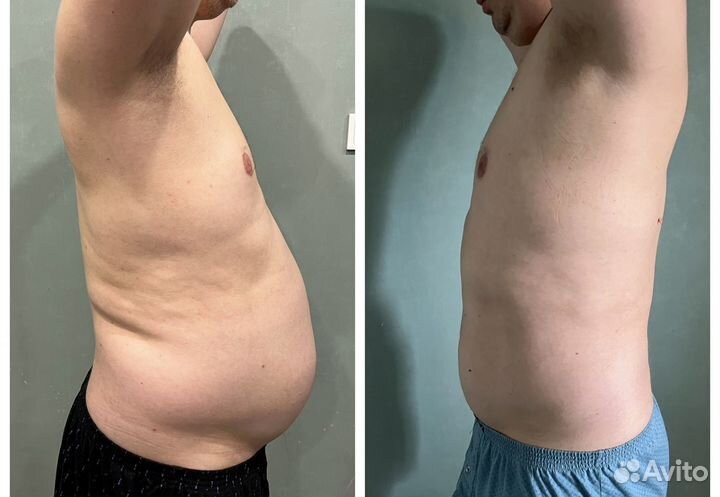 Комплекс по похудению