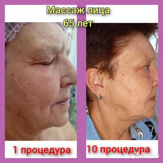 Шугаринг,обучение, массаж