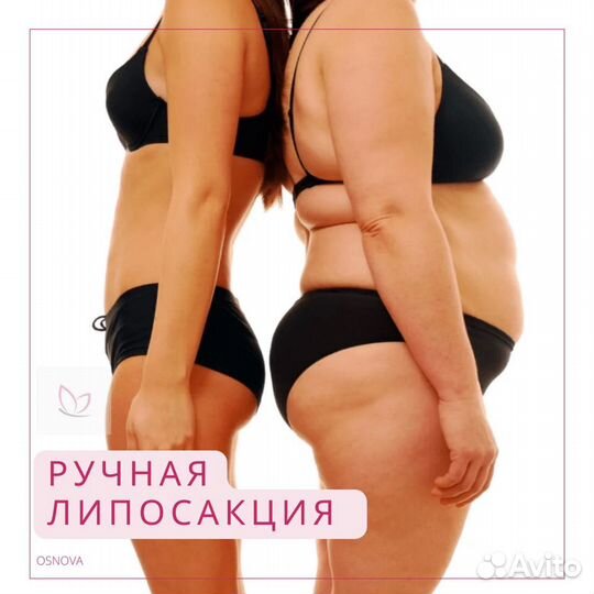 Антицеллюлитный массаж на дому