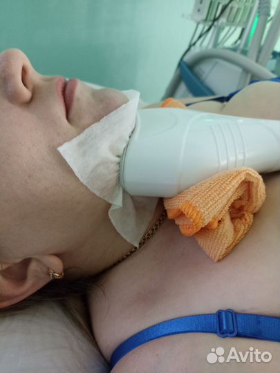 Криолиполиз